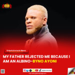 My father rejected me because I am an albino - Byno Ayoni