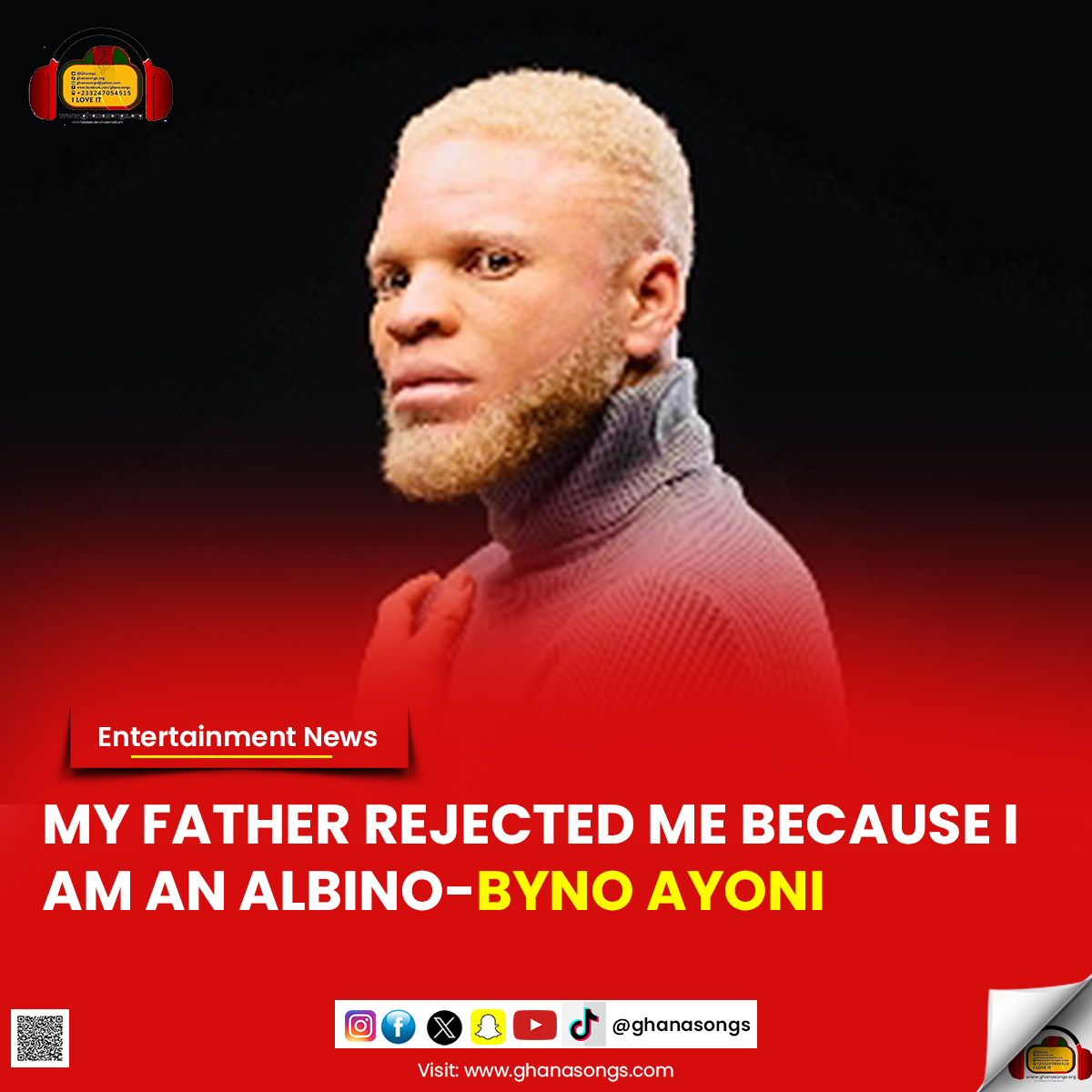 My father rejected me because I am an albino - Byno Ayoni